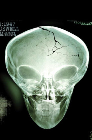 X FILES (2026) #1 COVER PACK PRE-ORDER